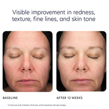Load image into Gallery viewer, Visible improvement in redness, texture, fine lines, and skin tone