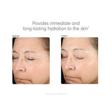 Load image into Gallery viewer, PCA SKIN Hyaluronic Acid Boosting Serum
