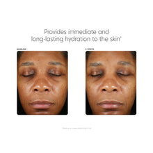 Load image into Gallery viewer, PCA SKIN Hyaluronic Acid Boosting Serum
