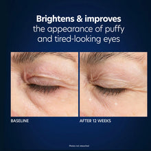 Load image into Gallery viewer, PCA SKIN Hyaluronic Acid Microneedle Eye Patches - Box of 4 Pairs
